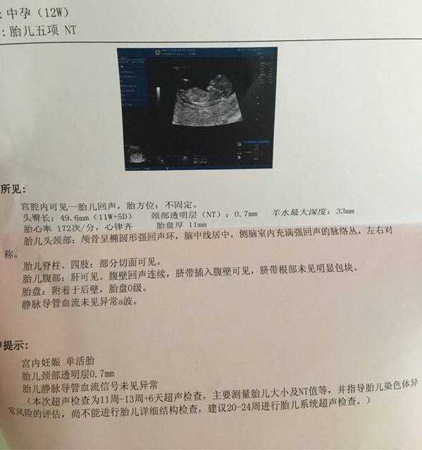 杭州供卵试管付款流程-青岛供卵盲捐的概念和意义