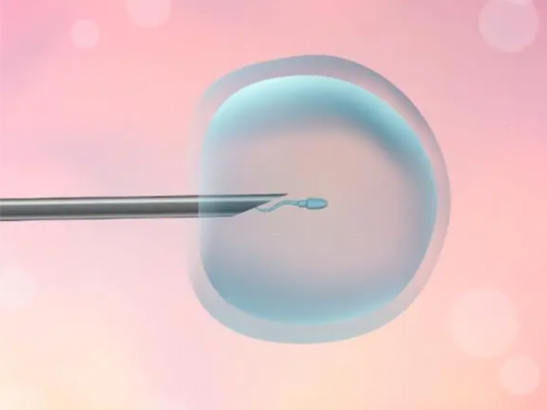 畸胎瘤手术后影响生育吗