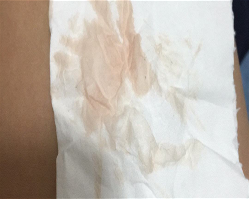 代孕供卵费用:男性备孕前体检项目