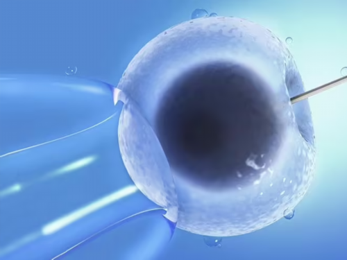 宫腔镜检查费用大约是多少呢什么时候做好，什么是宫腔镜检查