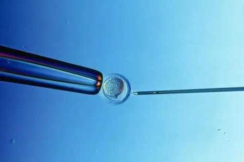 怀孕几天b超胎心胎芽