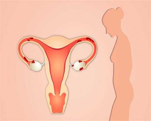 试管代生价钱-雌二醇1500对应几个成熟卵泡?试管促排雌二醇值多少?