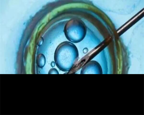 供卵价钱表-取卵后休息两个月移植好不好，卵巢早衰试管取卵后需要休息两个月吗