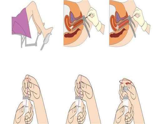 供卵产子公司:内膜厚度多少来月经