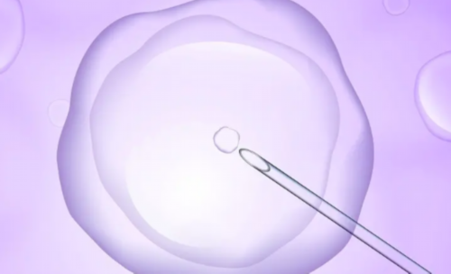 高龄产妇注意事项 高龄产妇要这样饮食