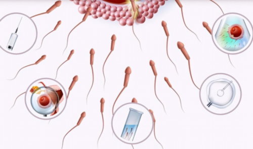 超声如何测量子宫内膜