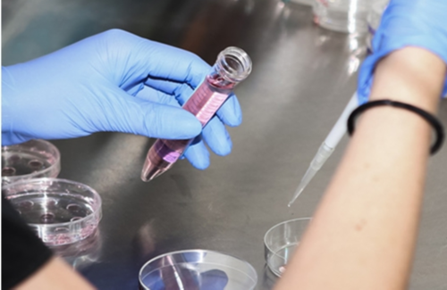 试管婴儿促排期间是否需要监测孕酮水平？为什么需要监测孕酮水平？