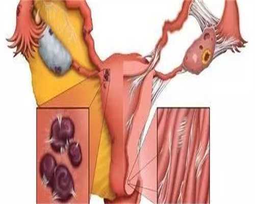 取20个全部空卵泡是什么原因？