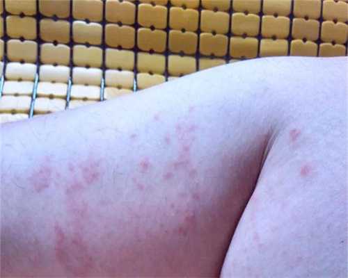 代孕宝宝特征：36岁卵巢功能下降还能自然怀孕吗？想怀孕应该怎么办？