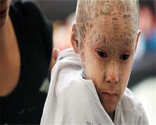 代孕套餐介绍-胚胎移植30天后出血怎么回事