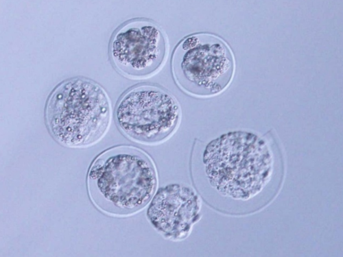 41岁AMH值多少正常，41岁做试管婴儿*率