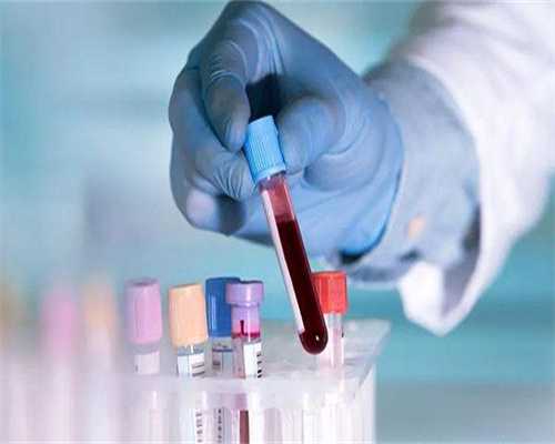 多囊卵巢综合症治疗要多少钱！多囊卵巢综合症治疗费用贵吗！