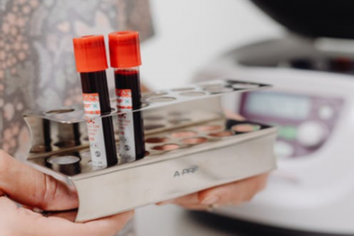 代孕包生孩子：拔智齿影响备孕吗（二胎备孕有哪些注意事项）