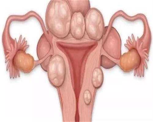 右侧卵巢囊性包块是什么意思