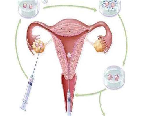 乌鲁木齐供卵三代试管婴儿医院排名，附三代试管婴儿生男孩流程！