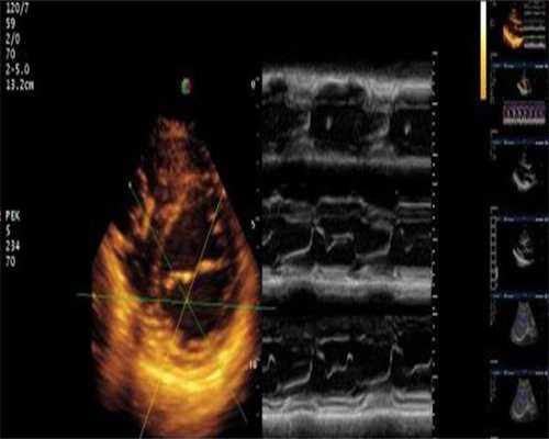 试管婴儿成功率取决于所取卵子的数量多吗?