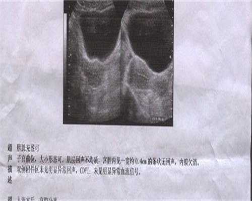 卵巢炎影响做试管吗_男性卵巢炎影响做试管吗