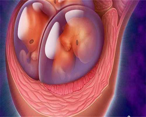 9号染色体三体是什么原因导致的主要有哪些因素