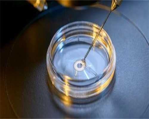 供卵代生网-卵巢过度刺激综合征的表现