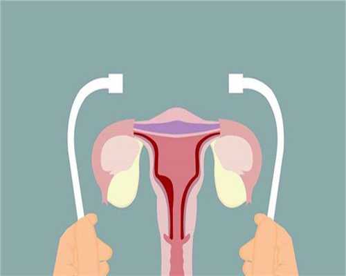 借卵怀孕:目前国外做试管婴儿需要多少钱?试管婴儿要多少钱