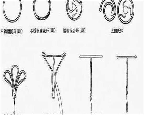 拮抗剂方案卵泡质量还能提升吗？拮抗剂方案卵泡质量好不好？