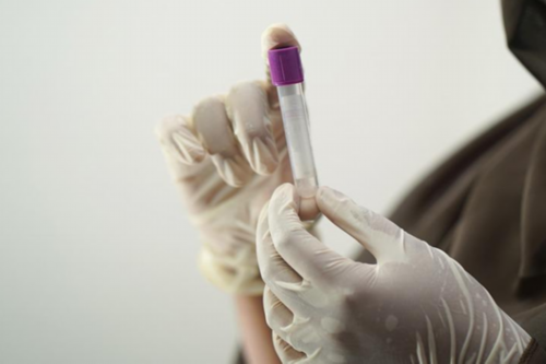 移植囊胚后饮食原则公开，避免大补很多人都忽略了