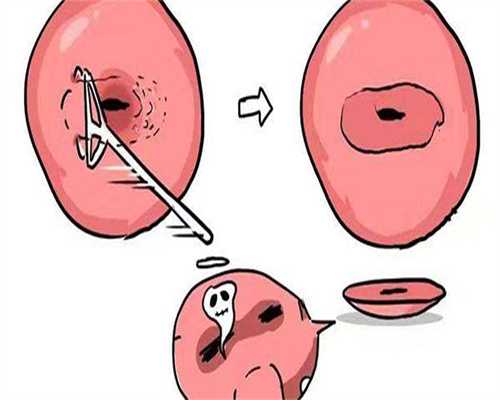 代生产子-hcg与孕周的对照表