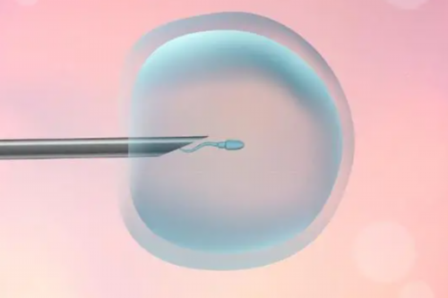 CBAVD试管成功率(二代试管生男生女概率)