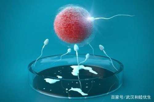 高龄妇女如何备孕(高龄产妇注意事项)