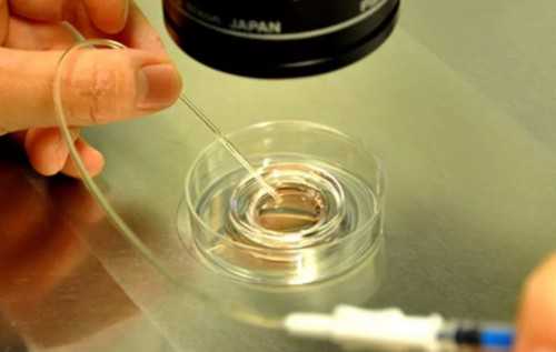 代生小孩费用：试管移植两个胚胎都能存活率高吗?做试管为什么要移植2个胚胎