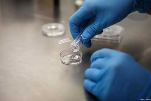 做完试管婴儿注意事项有哪些 做完试管婴儿需注意三个事项
