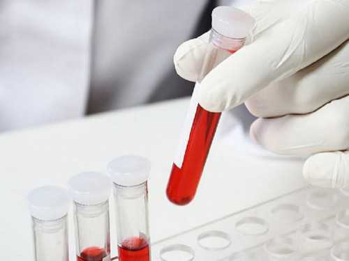 宫腔线不清晰严重吗