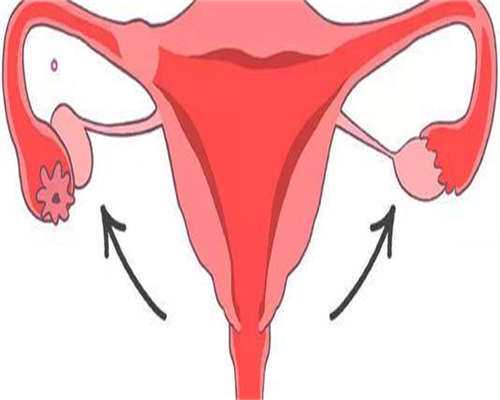 孕妇是否可以食用樱桃?樱桃对孕妇有哪些好处?