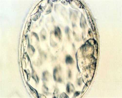 代孕包生男孩:怀孕吃氟康唑有影响吗