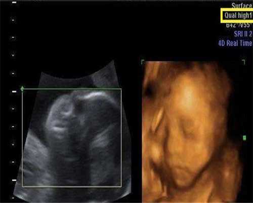 供卵生子医院-宝宝能长期吃益*菌吗，益*菌的正确食用