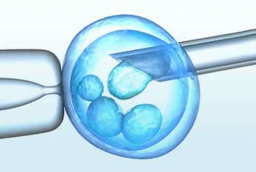 赴美做试管婴儿，移植前要不要做宫腔镜？