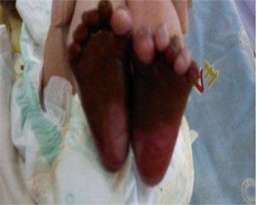 子宫动脉血流缺如意味着子宫动脉的血液供应不足,应该如何处理?