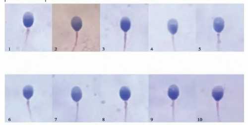供卵机构助孕：孕酮低能否做辅助生殖