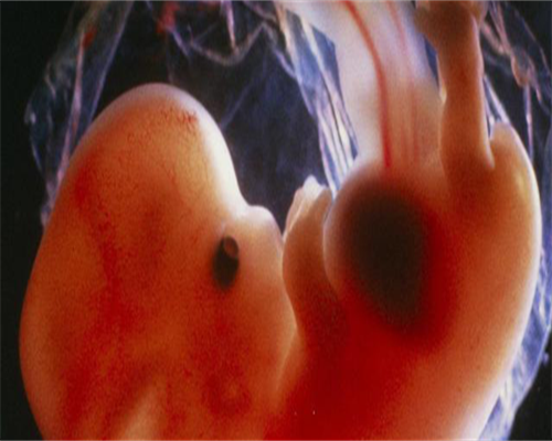 代生包生男孩-孕早期几周做b超合适