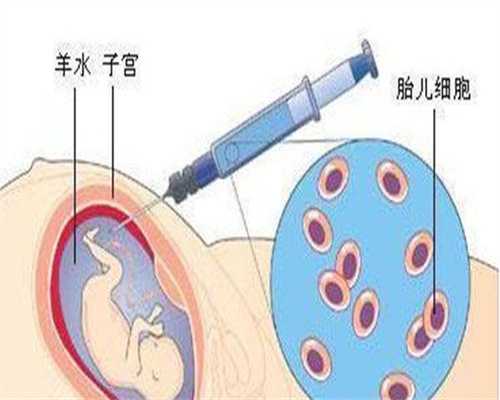子宫肌瘤剔除术后保养