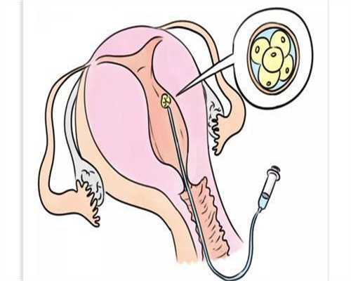 试管婴儿费用明细