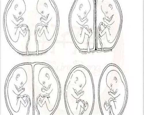 国外做试管婴儿有哪些突出优势？