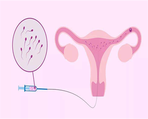 同房后液体流出来影响怀孕吗,听听专家怎么说