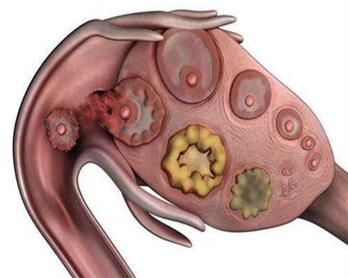 影响冻融胚胎成功的因素有哪些？
