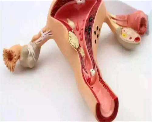 尿酸高的人生不出儿子，尿酸高的人该如何备孕呢！