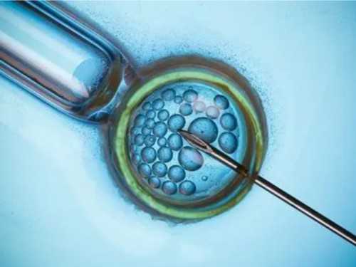 代生最权威：畸形*可以用试管婴儿治疗吗