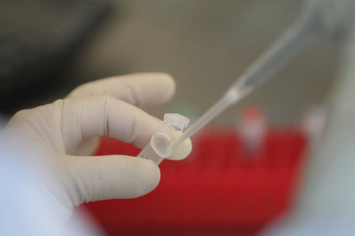 代孕供卵试管：孕前如何检查精子质量