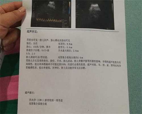 代孕包生女孩-试管移植后建议不要同房，对胚胎着床影响很大！