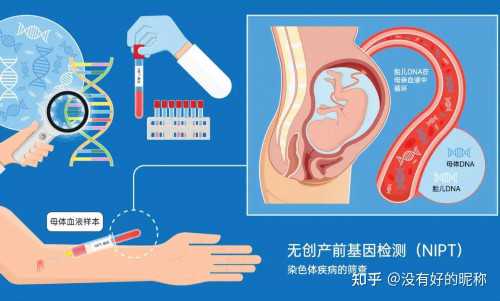 权威助孕医院-孕早期可以伸懒腰吗