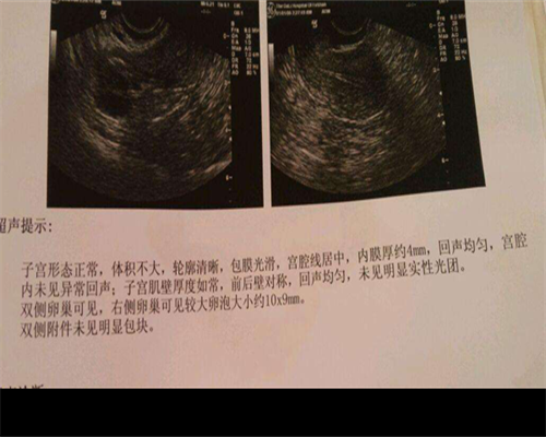 大龄卵巢早衰做试管，卵少成功率低怎么办？